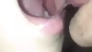 شيمل سالب وموجب